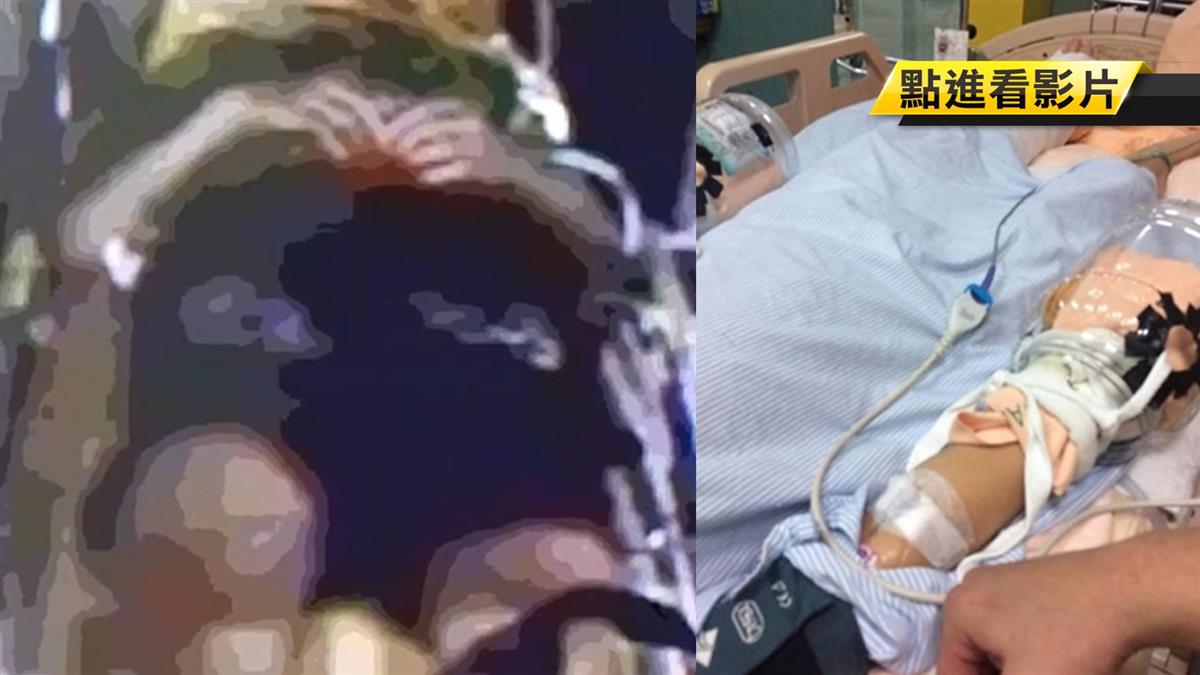 小六生校園墜樓!父痛揭兒「和同學道別」:校方說謊