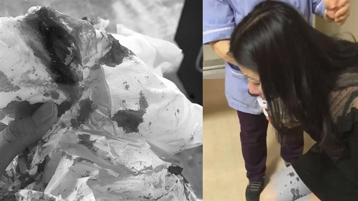 借錢不成爆毆女友!健身教練當街開打 女鮮血直流求救