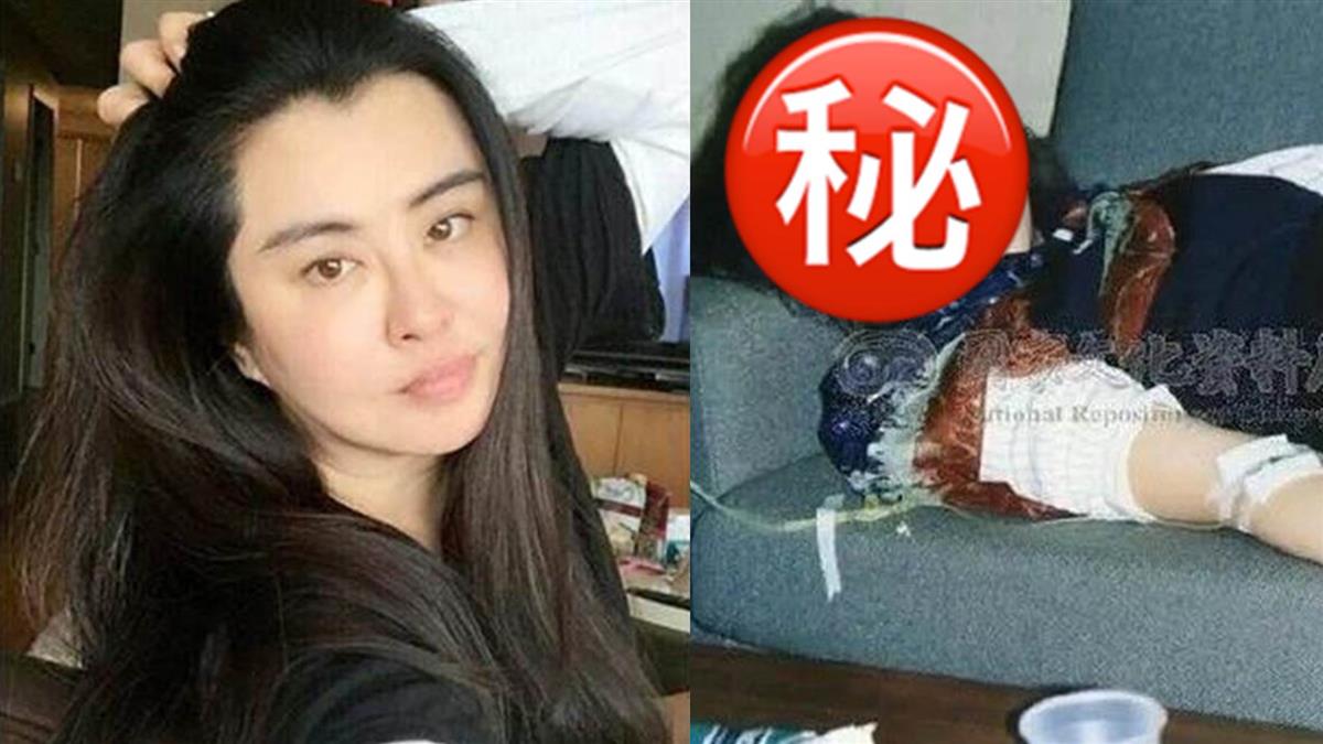 王祖賢病倒照外洩！ 網震驚：仙女連生病都美