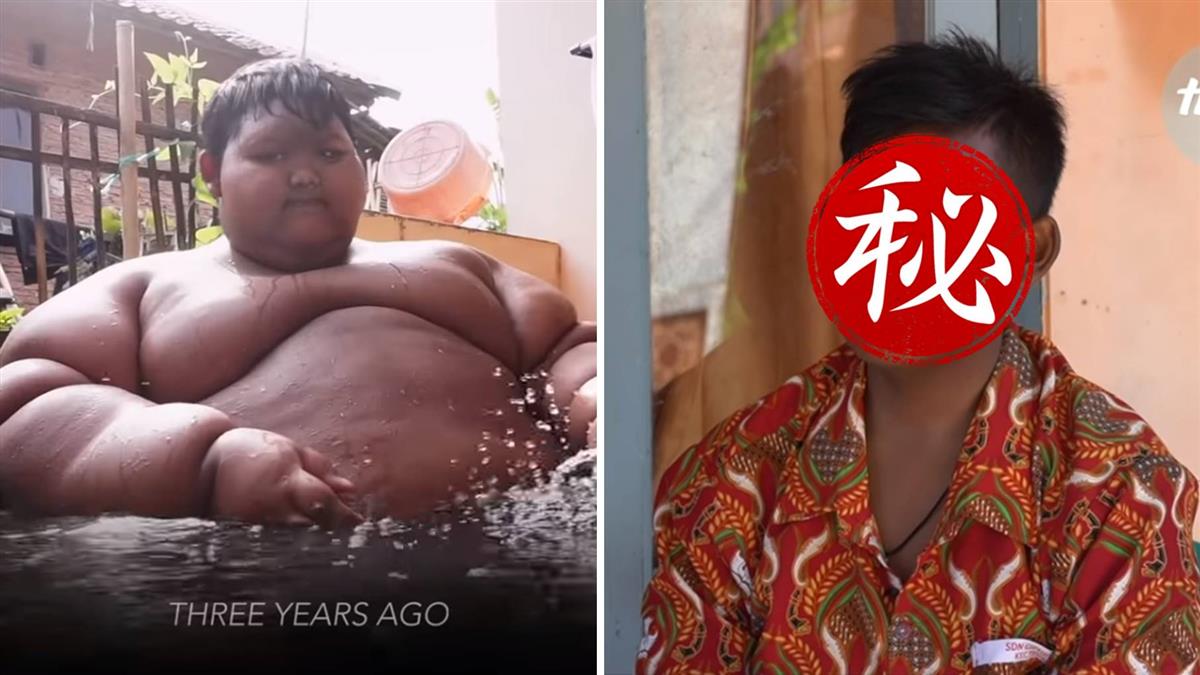 最胖男孩一日吃5餐!甩肉106Kg現狀曝光