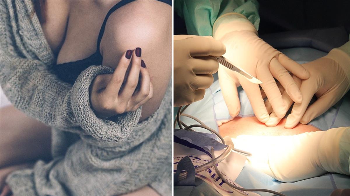 妻瞞家人隆乳…猝死手術台!尪淚崩:不敢回家