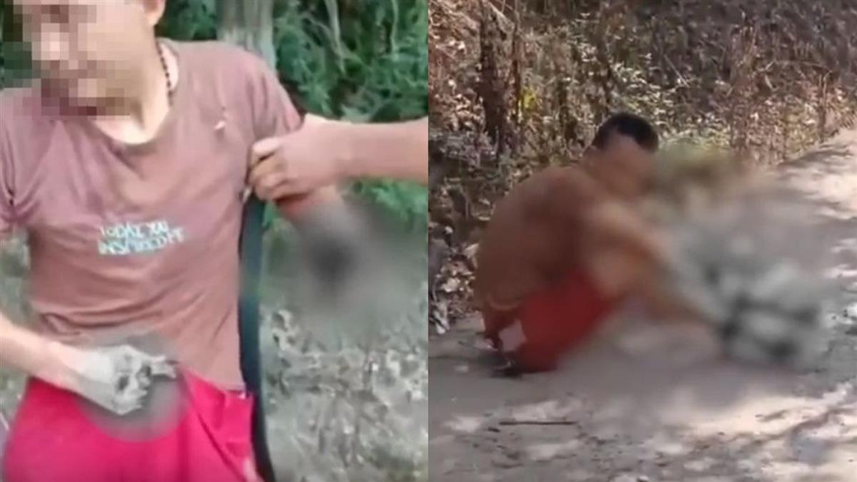 回家路上被撞飛!男子浴血淡定撿回斷肢