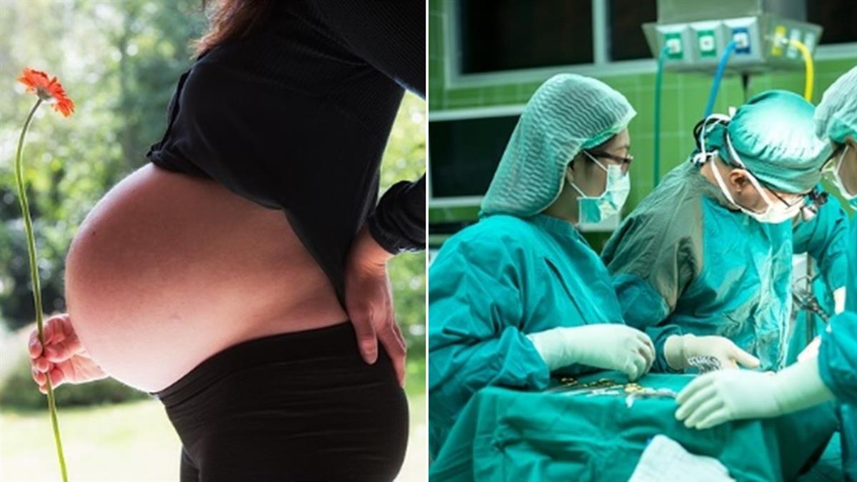 婆婆逼看時辰!她大出血剖腹遭阻 尪怒:不要來了