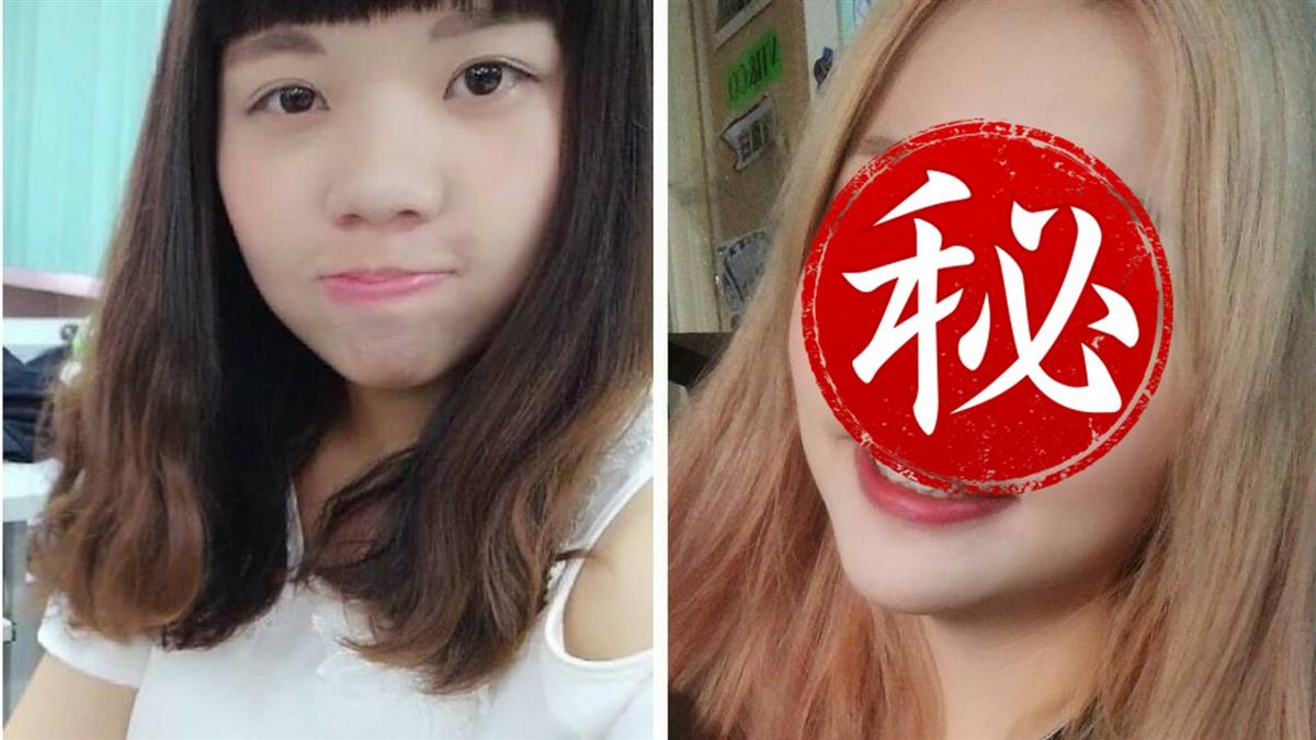 升級E罩杯！插畫家整形又隆乳 痛訴抽脂心聲