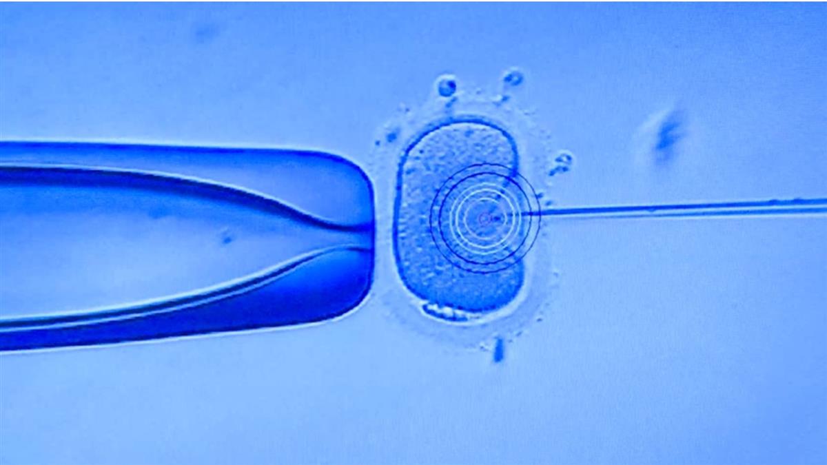 18年前就有！人工生殖法草案擱置 爭議不停