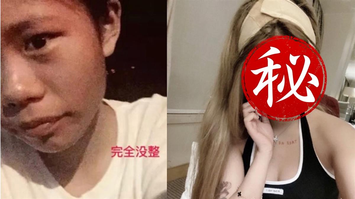 3年整60次！16歲網紅全臉磨骨 對比照超驚人
