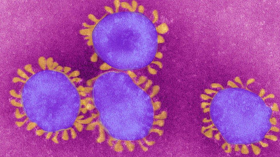 肺炎疫情:新冠病毒到底哪來的?科學界的幾種說法