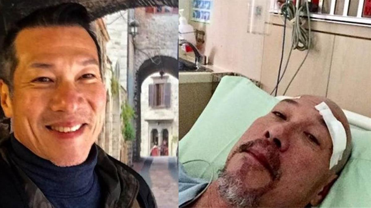 20年隱疾纏身！61歲黃仲崑腦部開刀竟全程不麻醉