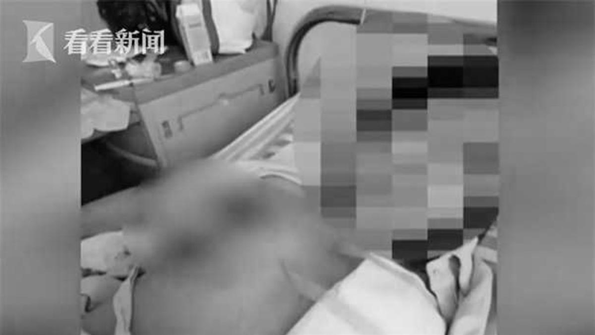 巨兇妹縮胸失敗 慘成十級傷殘被酸：無底洞