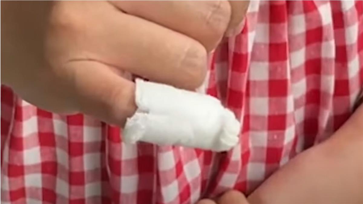 慶生驚魂!住墾丁五星飯店 遭15cm蜈蚣咬傷