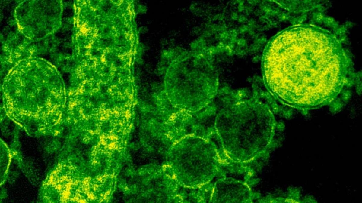 「瑯琊病毒」現世！醫曝關鍵8症狀 已有35例感染