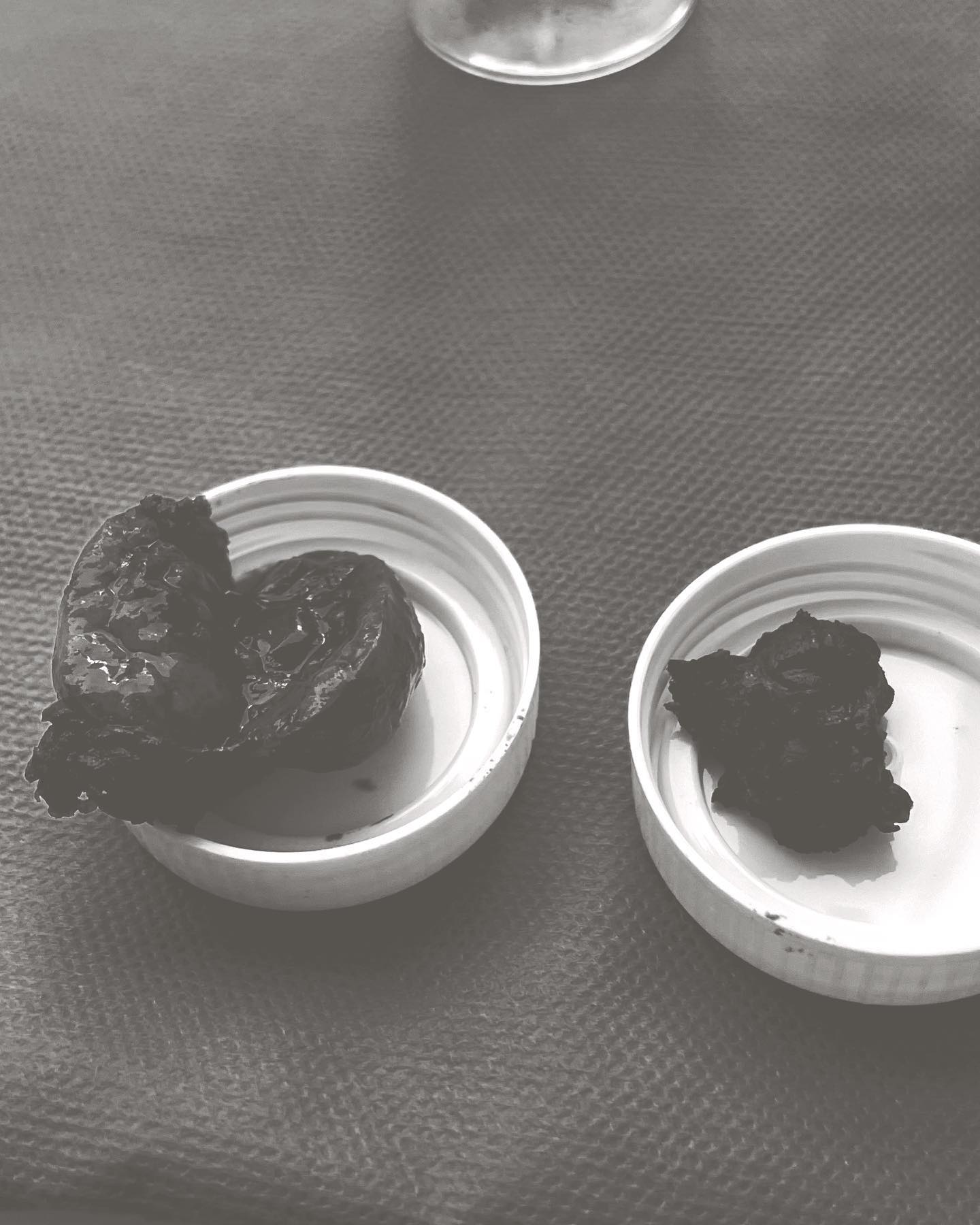 ▼林萱瑜秀出開刀取出的腫瘤，惹來粉絲心疼。（圖／翻攝自林萱瑜臉書）