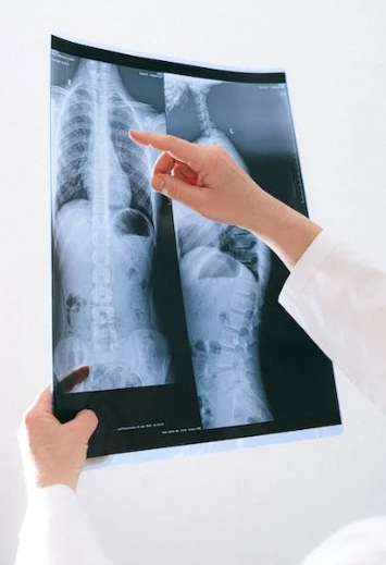 ▼醫生為少年照X光，明顯可見一顆球體就在他腹腔內。（示意圖／翻攝自pexels）