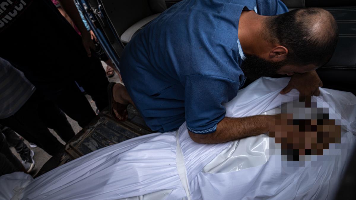 以巴衝突／以色列回擊！加薩醫院塞爆 實習醫獨撐外科