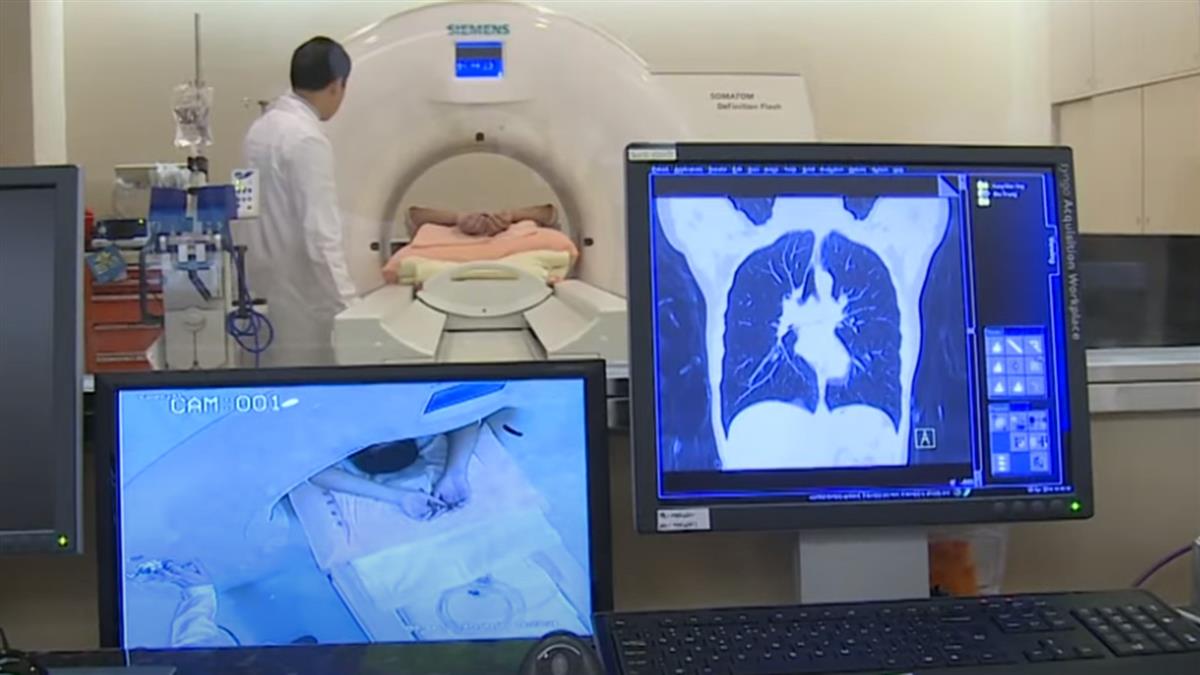 「肺癌」躍癌王！ 擠下連續15年榜首「大腸癌」