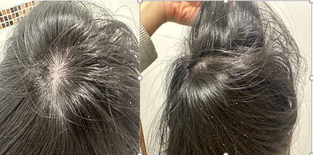 過年期間行程滿檔，洗頭常變得匆忙，導致油脂與污垢在頭皮堆積，毛孔堵塞。（圖／KA'FEN提供）