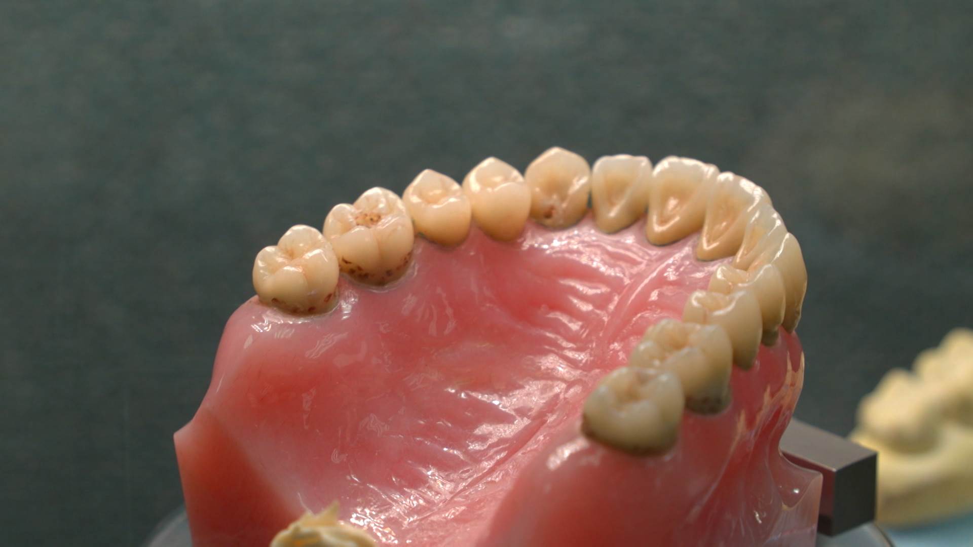 假牙配戴以及清潔照護，是否做好，也大大影響長者的健康與生活品質。（圖／東森新聞）