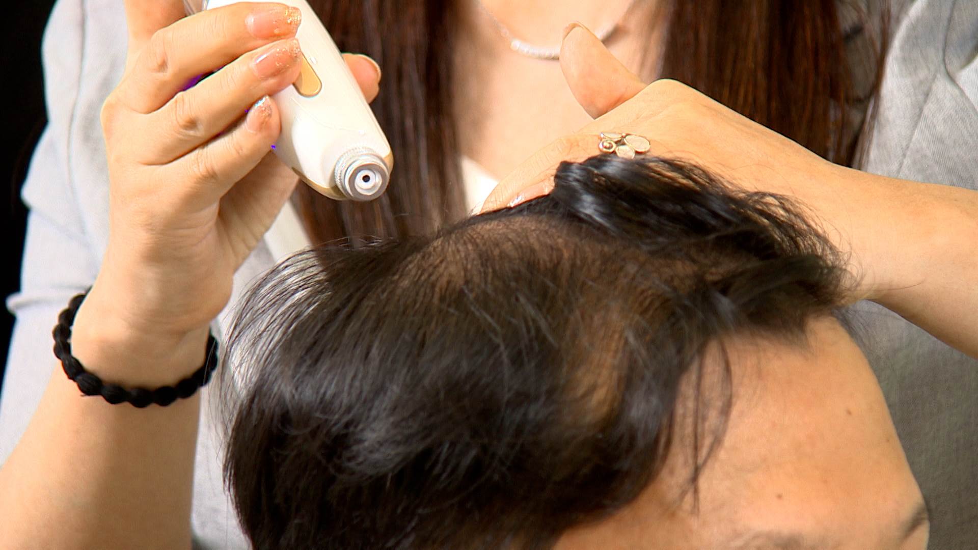 愛爾麗集團醫師強調，頭皮管理不僅適合落髮患者，更能預防頭皮健康隱憂。（圖／東森新聞）