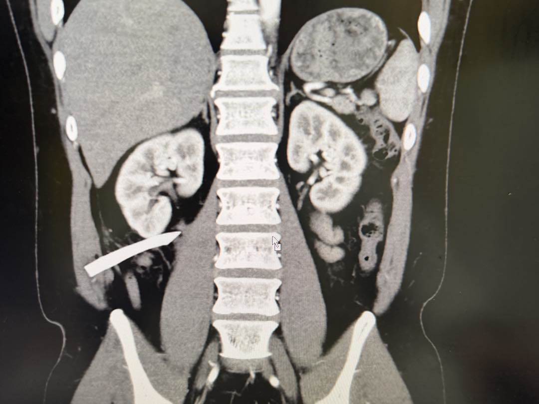 685005947_1409444084535204_7463209310812579202_n