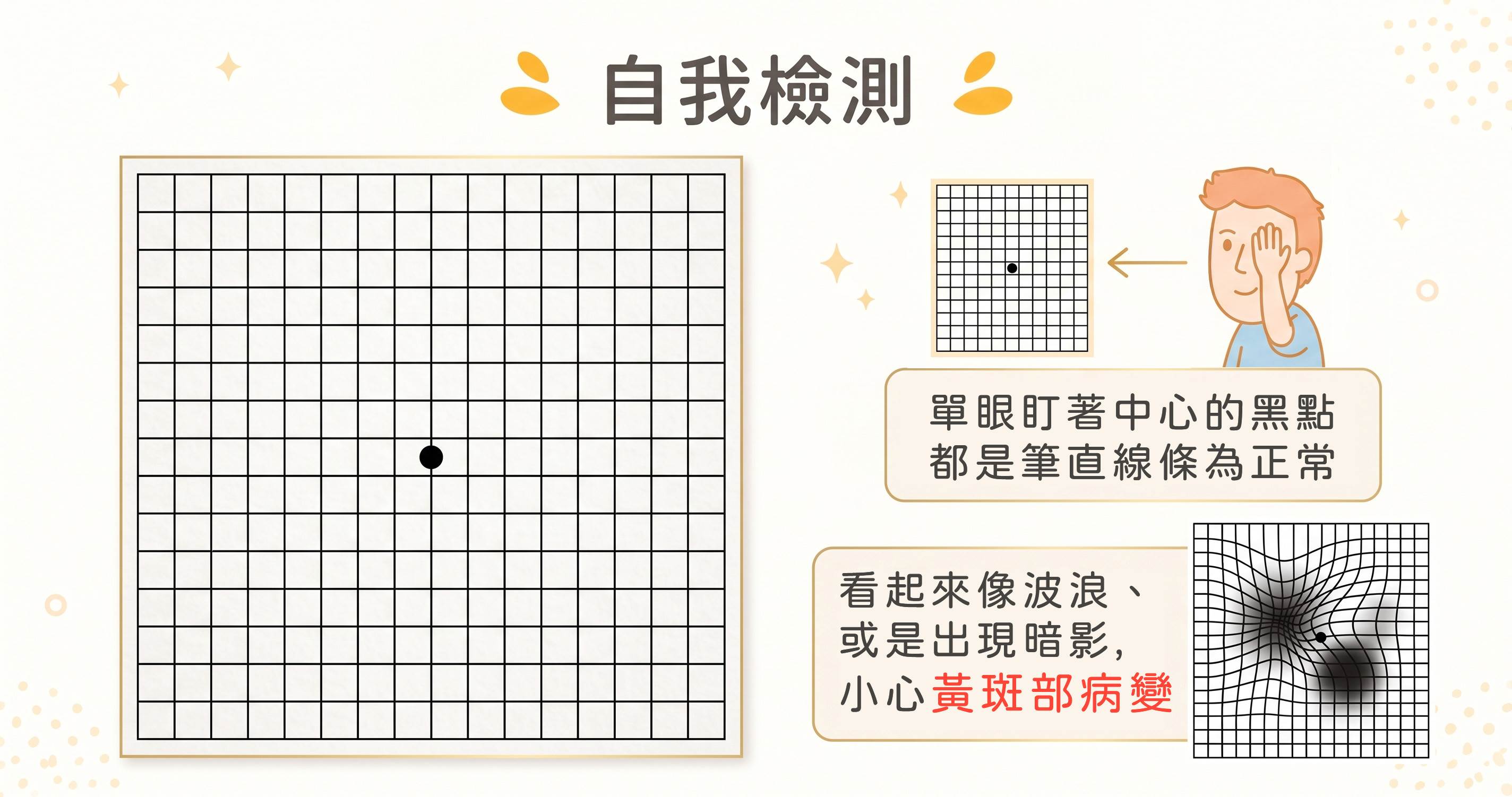 利用「阿姆斯勒方格表」自我檢測，若看起來波浪或出現暗影要小心。（圖／AI生成）