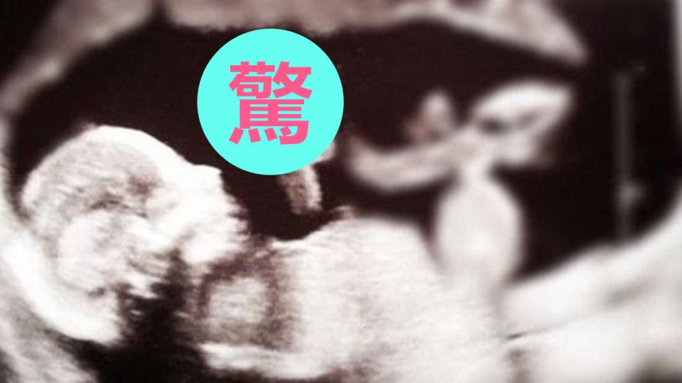 驚呆了!超音波照 竟看到北鼻伸手比...