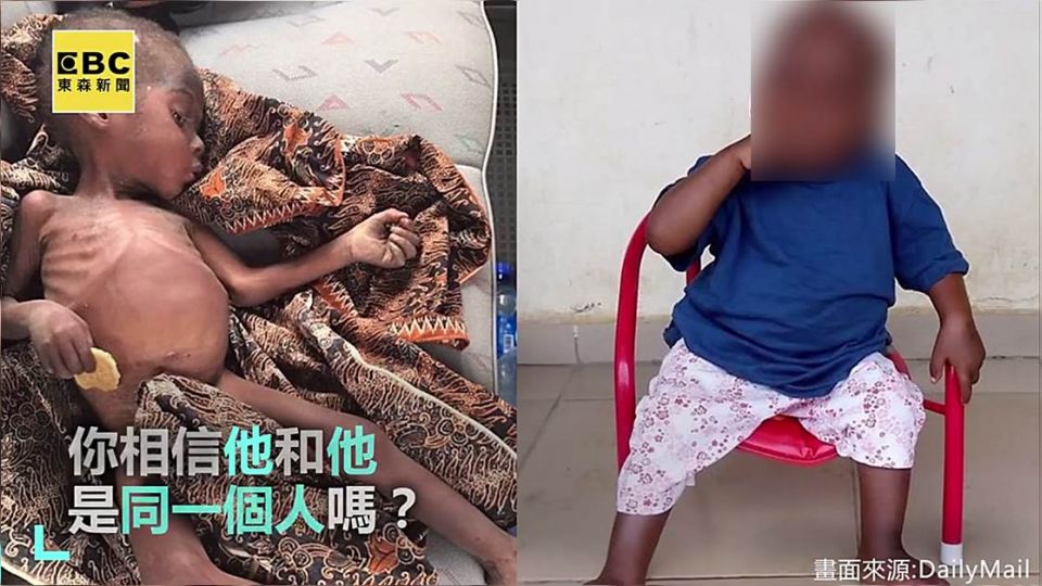昔遭遺棄險餓死 今成萌娃快樂長大