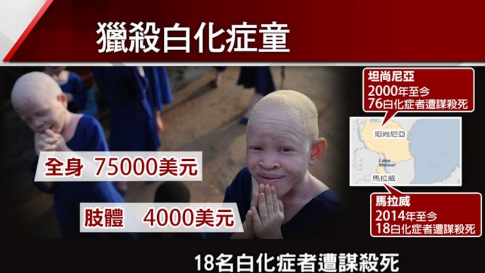 東非「獵殺白化童」 竟是為祈福添好運