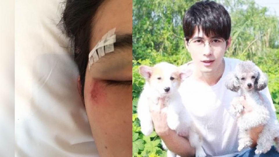 拍戲過勞？《小時代》陳學冬帥臉濺血縫6針 粉絲崩潰