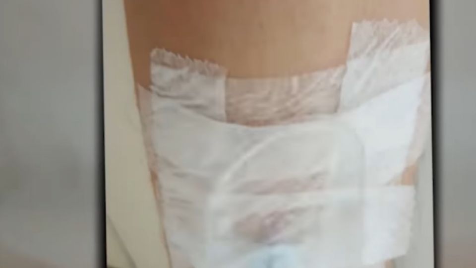 歲男罹肺腺癌 抗癌日記最後結局……好催淚