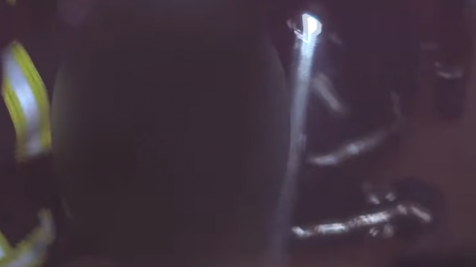 電暖器爆炸？93歲老翁全身95%燒燙傷