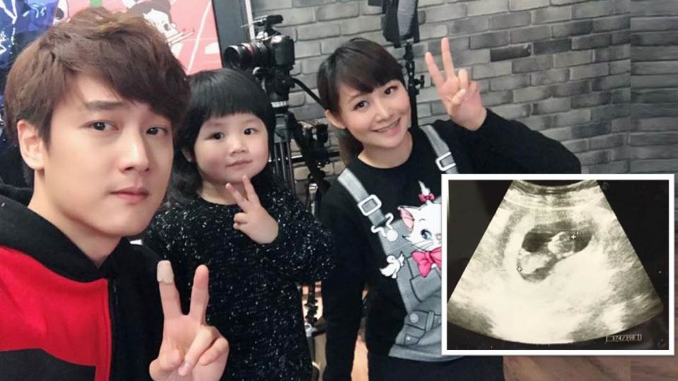 「那對夫妻」曬超音波照報喜！Kim放閃告白：偉大的老婆