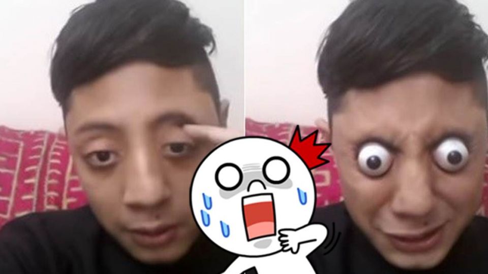 嚇到「眼珠快掉下來」!巴國少年眼球爆噴1公分 拚世界紀錄