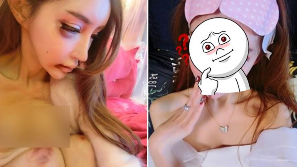 陸第一網紅遭「毆胸變形」 只花5天「神恢復」！