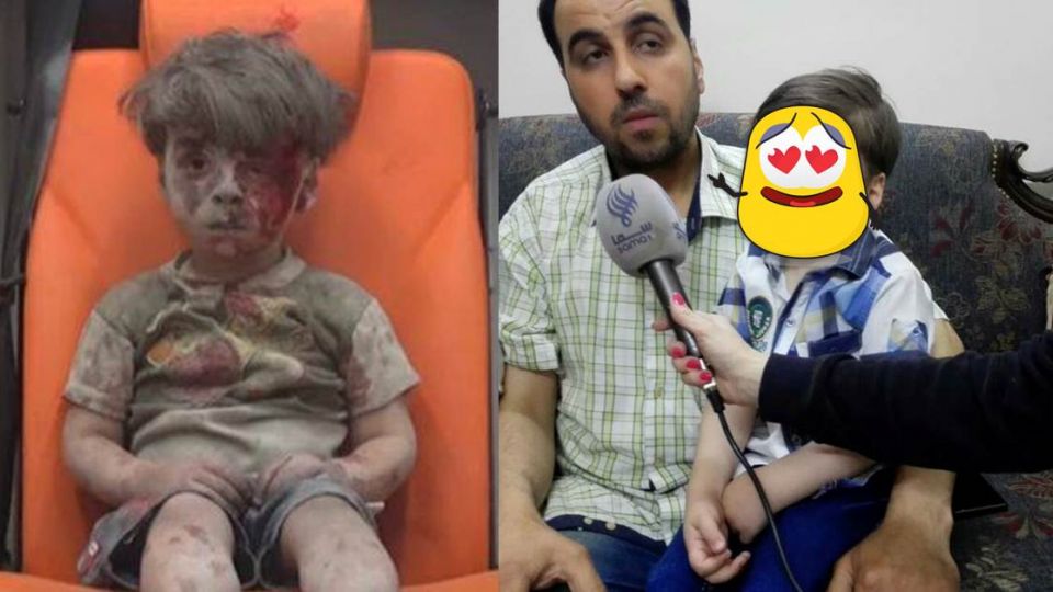 全身佈滿塵土和鮮血…「戰火男童」重生後萌樣曝光