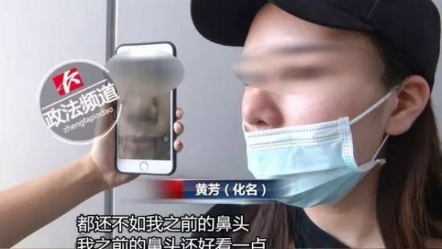 26歲女貸款30萬整形反變醜!醫美嗆:要變美先變鬼