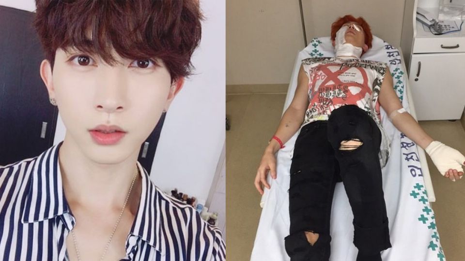 【影片】男偶像拍MV遇爆炸！數十碎片飛濺射臉「二度灼傷恐毀容」