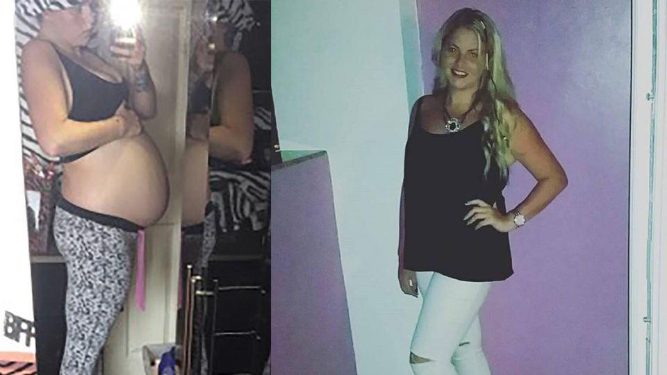 以為懷孕8個月！女子肚藏「30公分大囊腫」…6周胎兒慘遭壓死