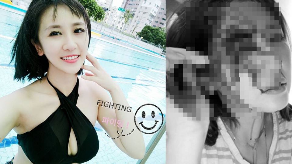 頭破噴血還自拍PO網挨轟 女星認錯：我真不知道是不對的
