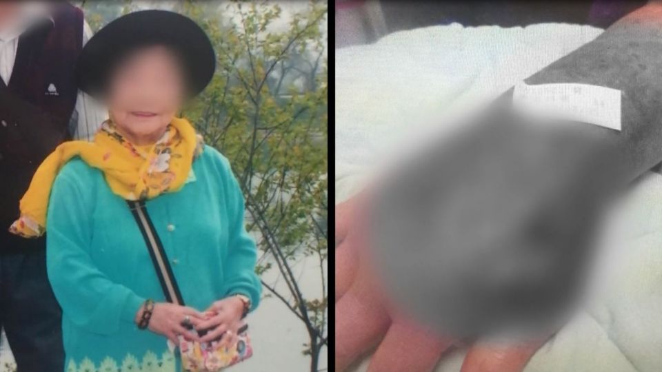 吃秋蟹遭割傷！婦染「海洋弧菌」拒截肢…4天後喪命！