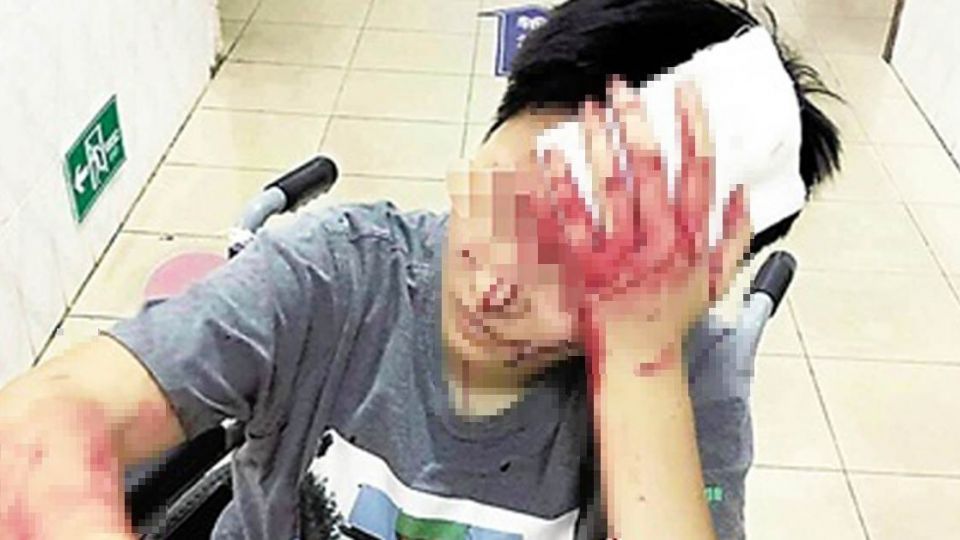 正妹女大生枯等外送2小時！ 自行取餐「被砸破頭」