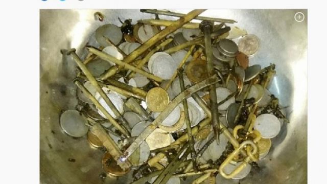 印度男猛吃7kg異物!胃藏100根釘263枚幣 醫:第1次看到