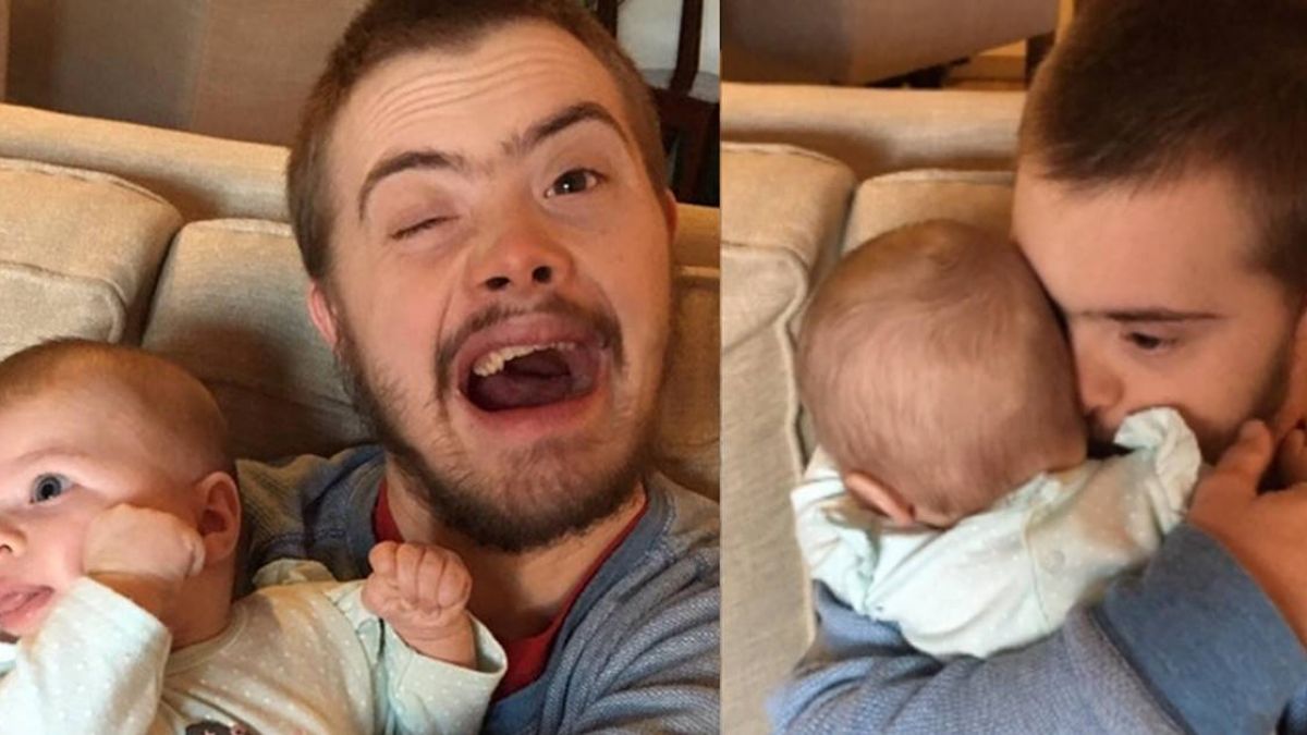 новорожденный с синдромом дауна. женщины с синдромом дауна родившие ребенка. родила дауна. синдром дауна причины. синдром дауна у пожилых.