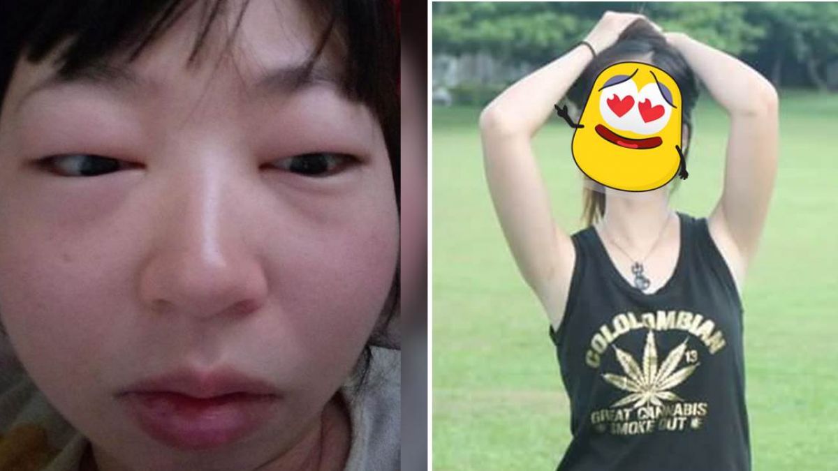 正妹吃飽睡好 隔天起床腫成大豬頭!原因居然是這個