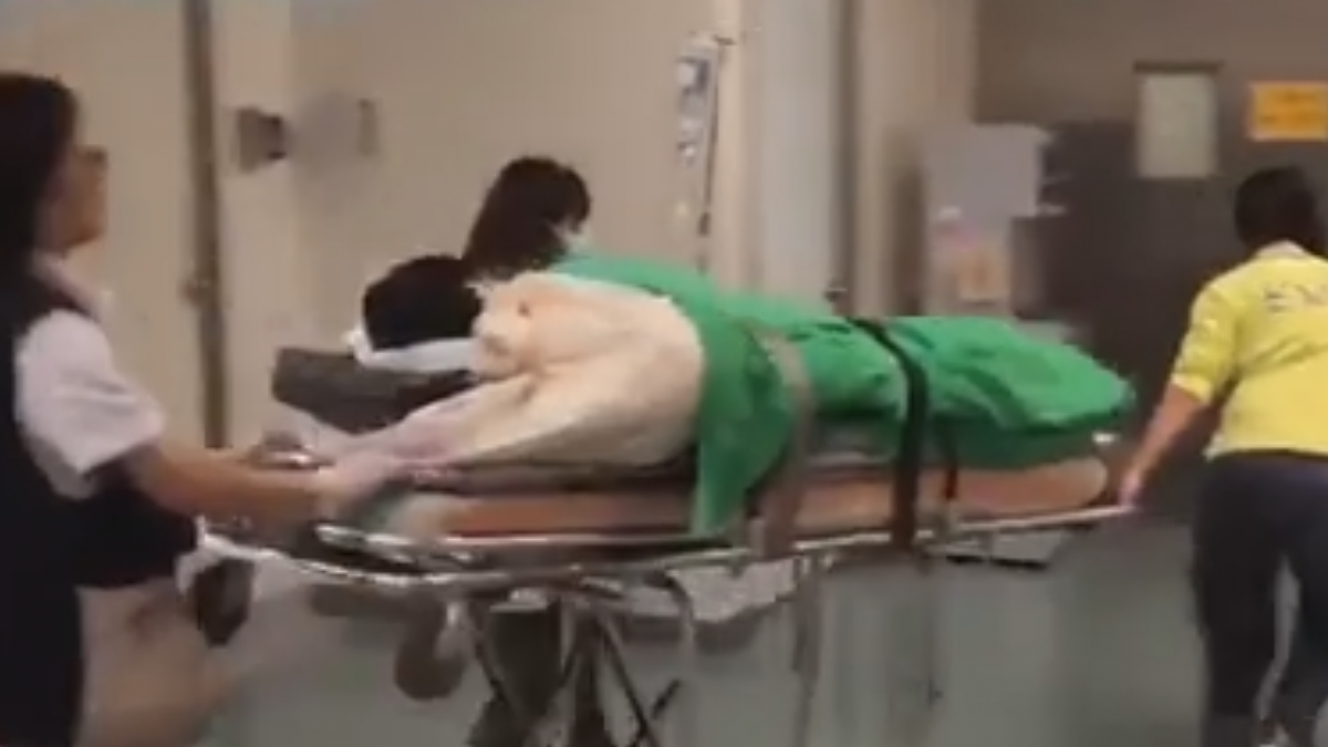 便當店氣爆店長臉手燒燙傷 送醫喊「我會不會毀容」