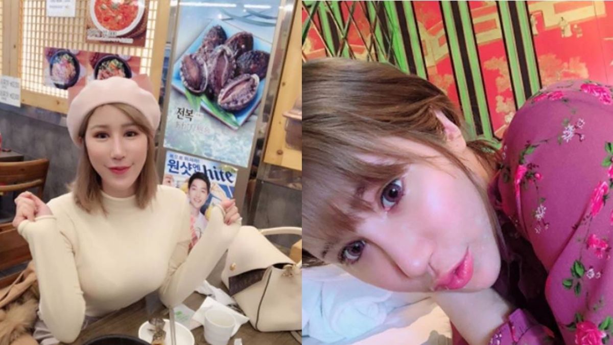 爆紅被罵翻「胸部又假又噁」　辛尤里想輕生：覺得整得很失敗