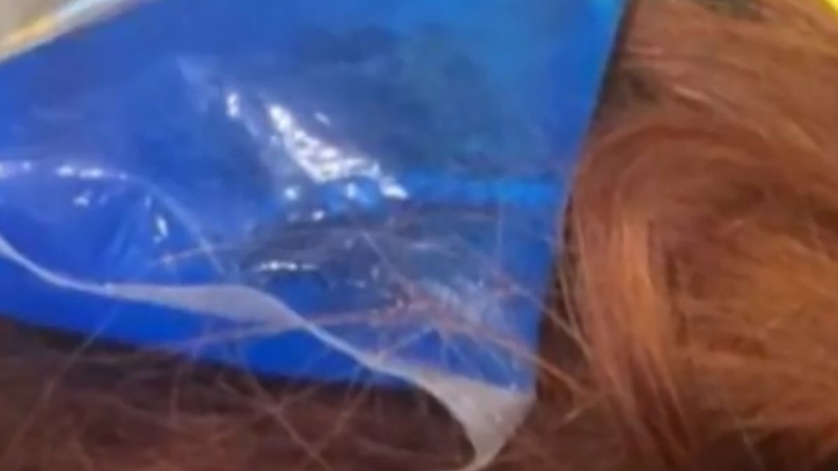 白冰冰錄影跌倒 後腦撞舞台階梯紅腫冰敷