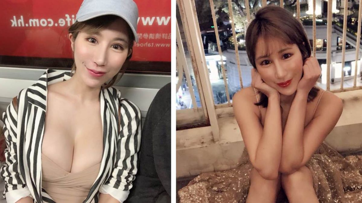 F奶有缺角…辛尤里狠砸24萬重做！水滴軟胸背後代價超慘痛