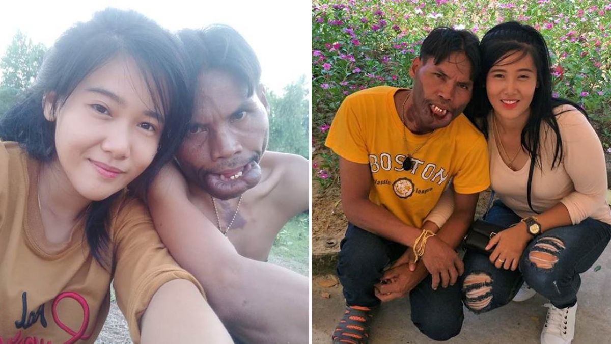 美女前妻再婚罕病男!前夫崩潰酸「為了錢」 秒遭她打臉
