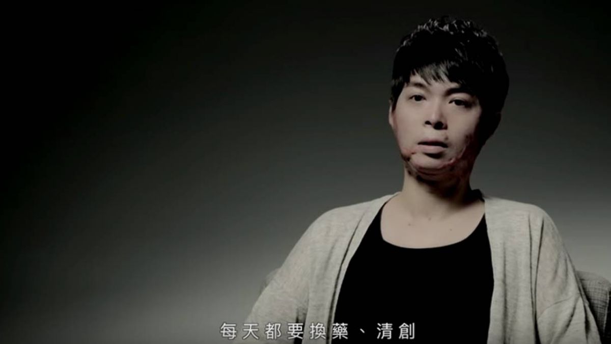 從氣爆中重生 消防役男的修復人生之路