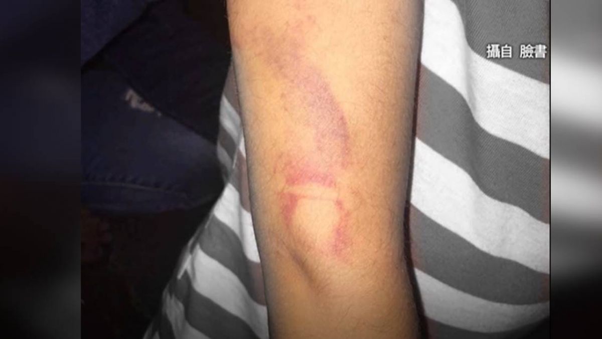 狠父家暴3月大男嬰引熱議 再爆3歲兒也慘遭痛毆